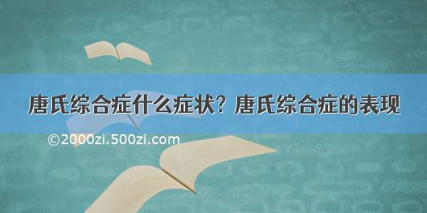 唐氏综合症什么症状？唐氏综合症的表现