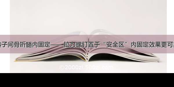 转子间骨折髓内固定——拉力螺钉置于“安全区”内固定效果更可靠