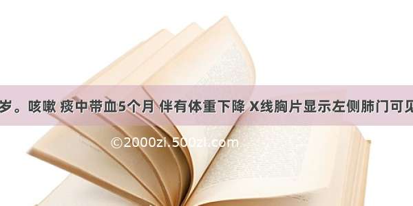 患者男 64岁。咳嗽 痰中带血5个月 伴有体重下降 X线胸片显示左侧肺门可见1个3cm×