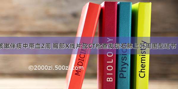 男 56岁。咳嗽伴痰中带血2周 胸部X线片及CT检查发现右肺上叶周围型结节 痰细胞学检